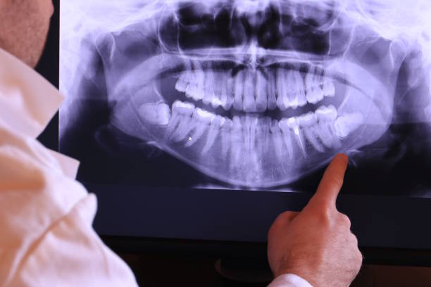 Best Emergency Root Canal Treatment in Long Grove, IL