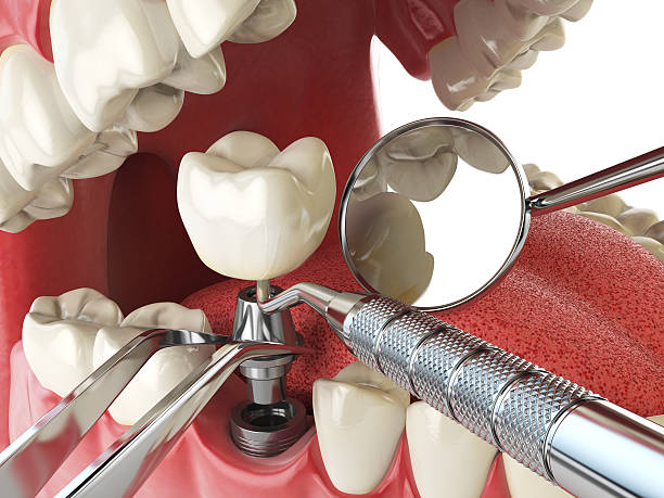 Best Emergency Dental Services for Seniors in Long Grove, IL